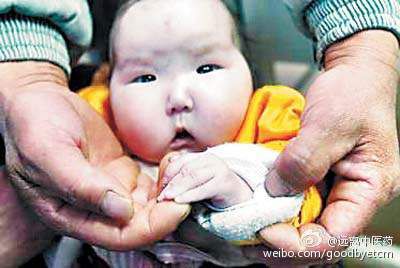 阿膠頻繁提價遭質疑 被指功效與豬皮膠無差異